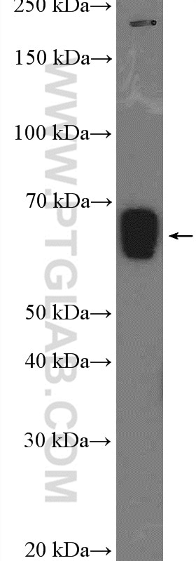 Western Blot (WB) analysis of rat liver tissue using SLC22A7 Polyclonal antibody (26796-1-AP)