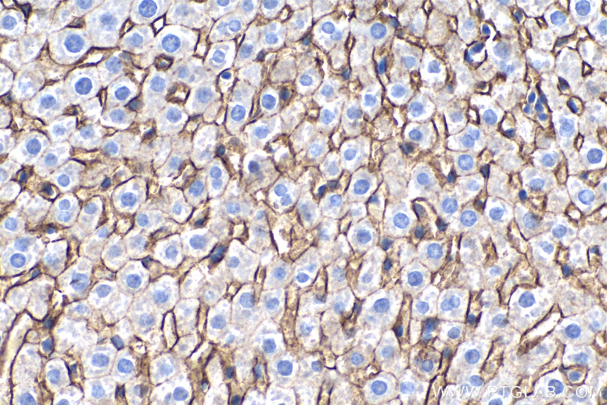 Immunohistochemistry (IHC) staining of mouse liver tissue using SLC22A7 Monoclonal antibody (67479-1-Ig)