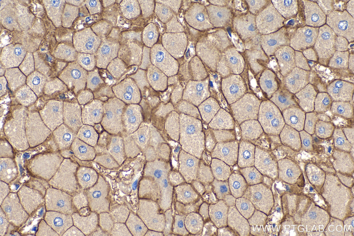 Immunohistochemistry (IHC) staining of human liver tissue using SLC22A7 Monoclonal antibody (67479-1-Ig)
