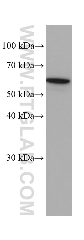 Western Blot (WB) analysis of SMMC-7721 cells using SLC22A7 Monoclonal antibody (67479-1-Ig)