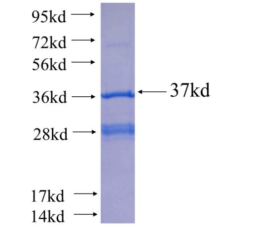 SLC22A7 fusion protein Ag25217 SDS-PAGE