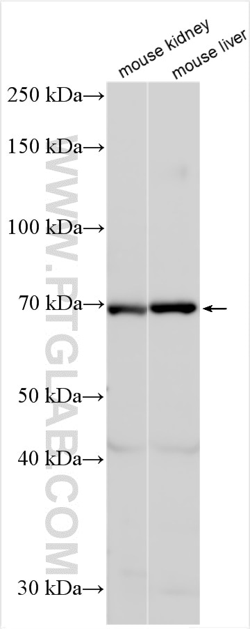 Western Blot (WB) analysis of various lysates using OAT3/SLC22A8 Polyclonal antibody (16844-1-AP)