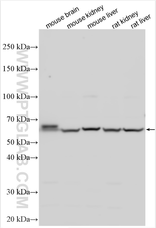 Western Blot (WB) analysis of various lysates using OAT3/SLC22A8 Polyclonal antibody (16844-1-AP)