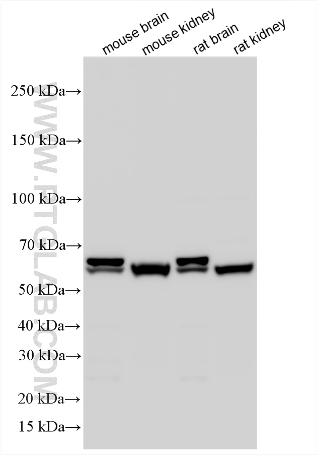 Western Blot (WB) analysis of various lysates using OAT3/SLC22A8 Polyclonal antibody (16844-1-AP)