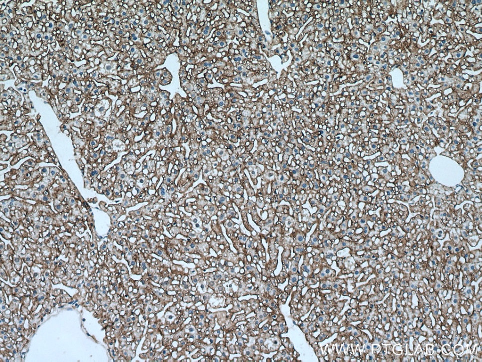 Immunohistochemistry (IHC) staining of mouse liver tissue using SLC22A9 Polyclonal antibody (27998-1-AP)