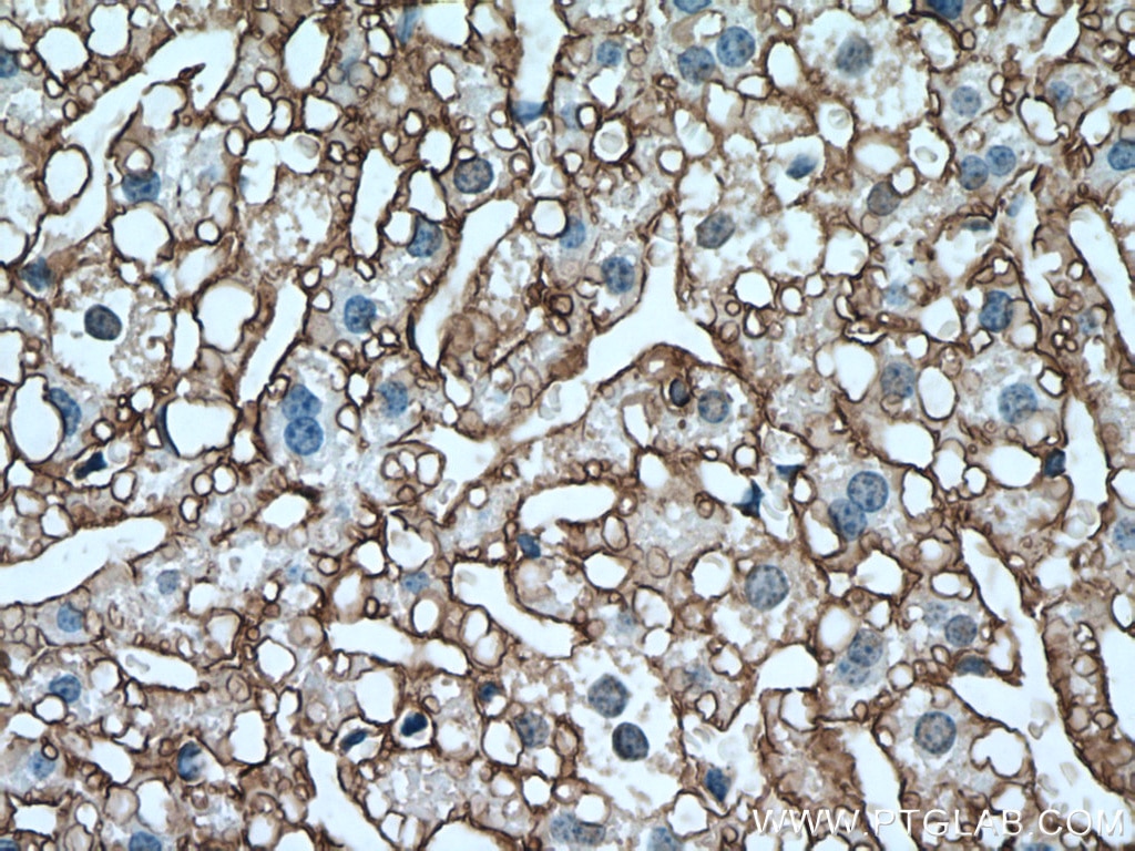 Immunohistochemistry (IHC) staining of mouse liver tissue using SLC22A9 Polyclonal antibody (27998-1-AP)