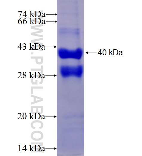 SLC22A9 fusion protein Ag27573 SDS-PAGE