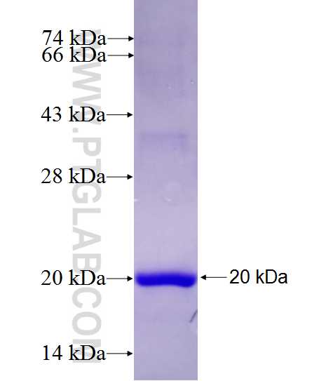 SLC22A9 fusion protein Ag27584 SDS-PAGE
