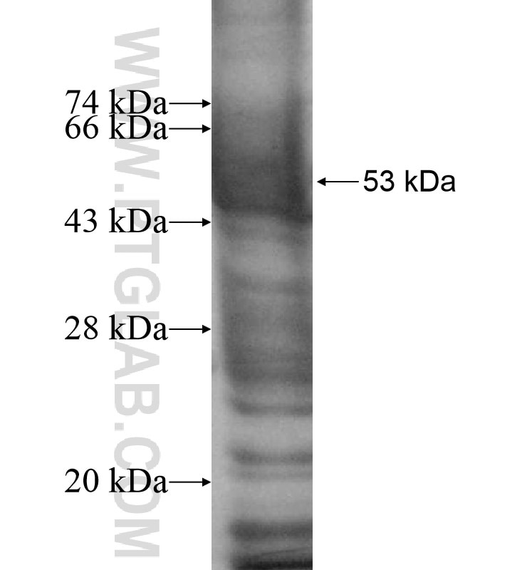 SLC22A9 fusion protein Ag13032 SDS-PAGE