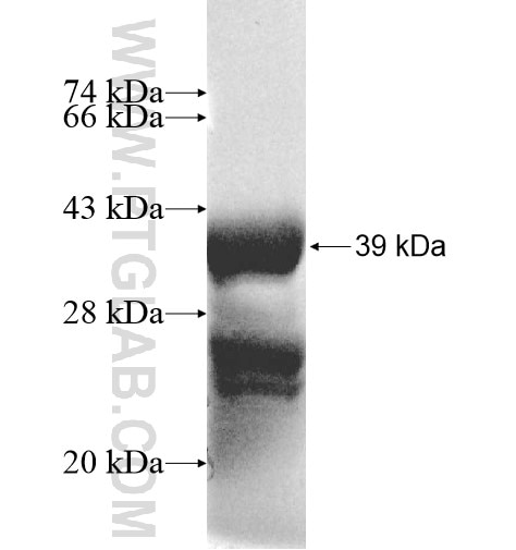 SLC23A3 fusion protein Ag11430 SDS-PAGE