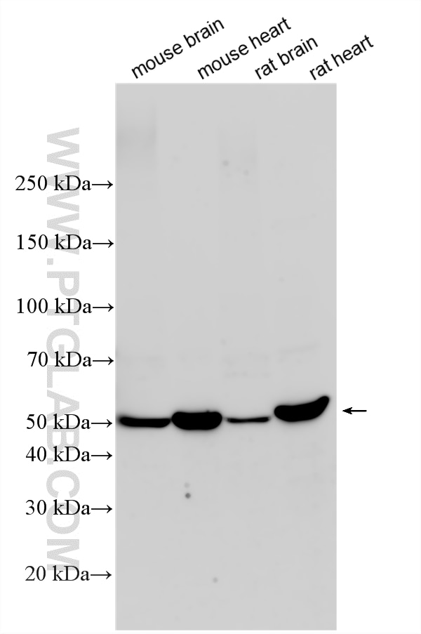 WB analysis using 27591-1-AP (same clone as 27591-1-PBS) Western Blot (WB) analysis of various lysates using SLC24A3 Polyclonal antibody (27591-1-AP)