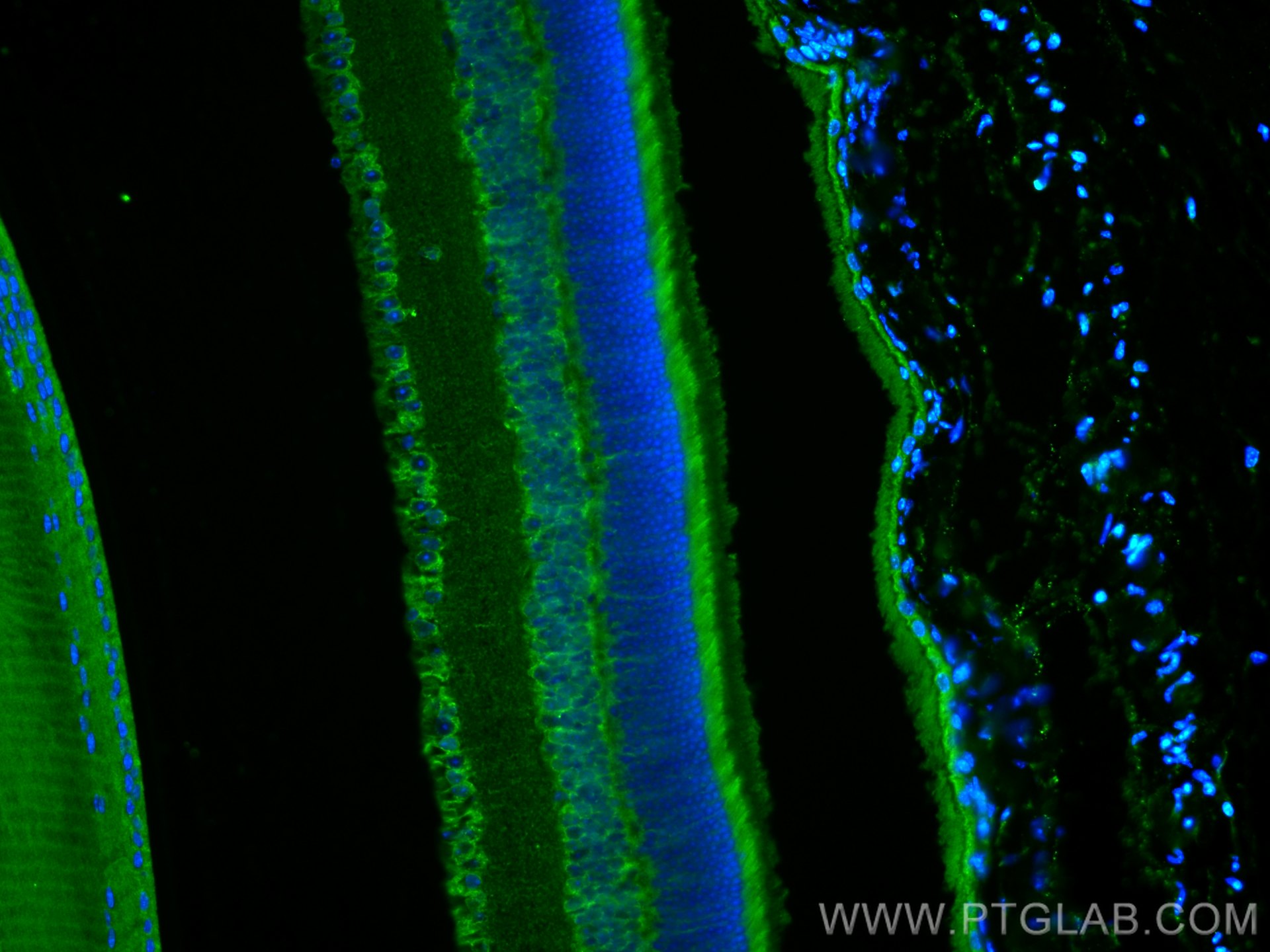 IF Staining of mouse eye using 18992-1-AP