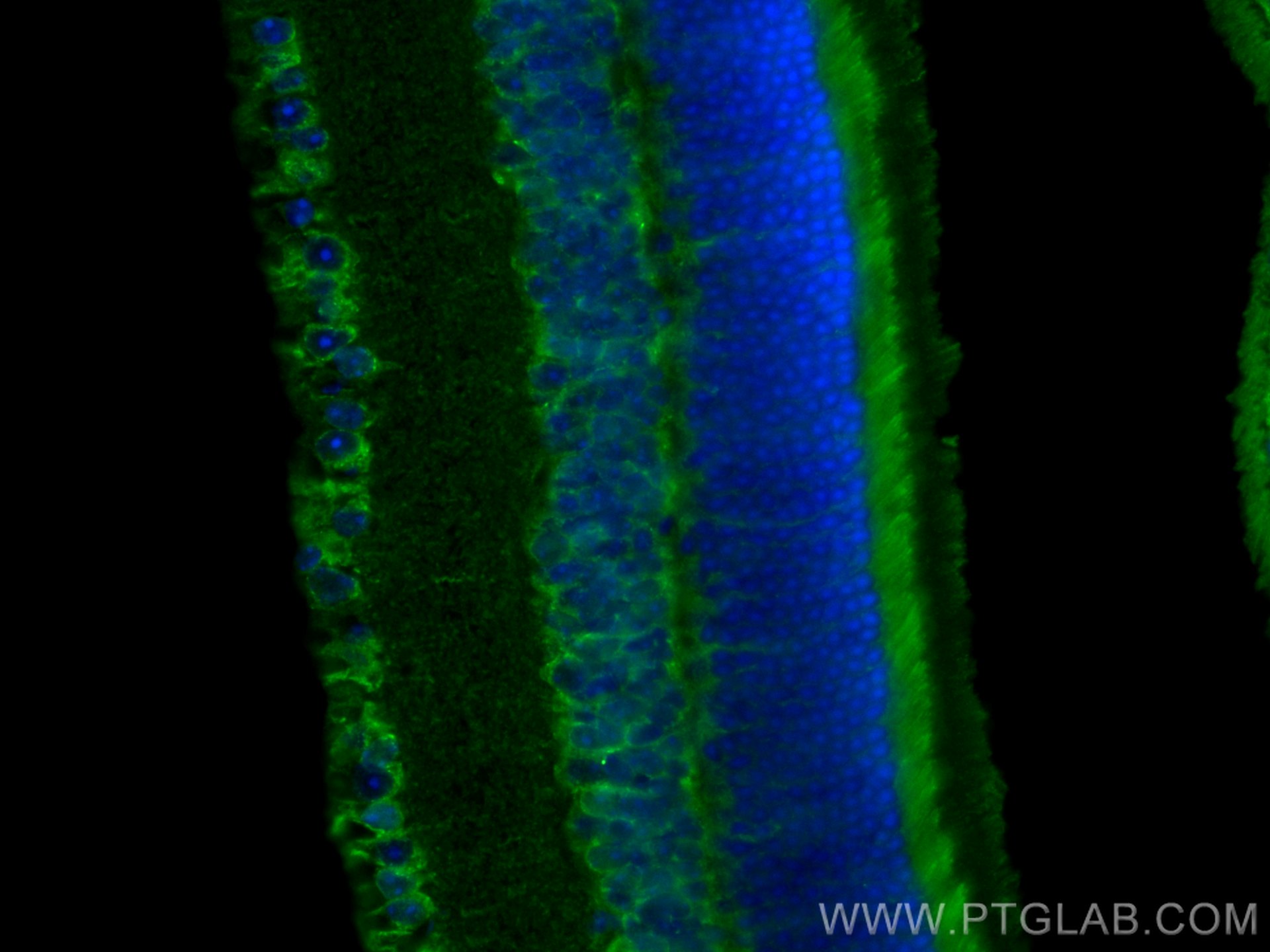 Immunofluorescence (IF) / fluorescent staining of mouse eye tissue using SLC24A4 Polyclonal antibody (18992-1-AP)