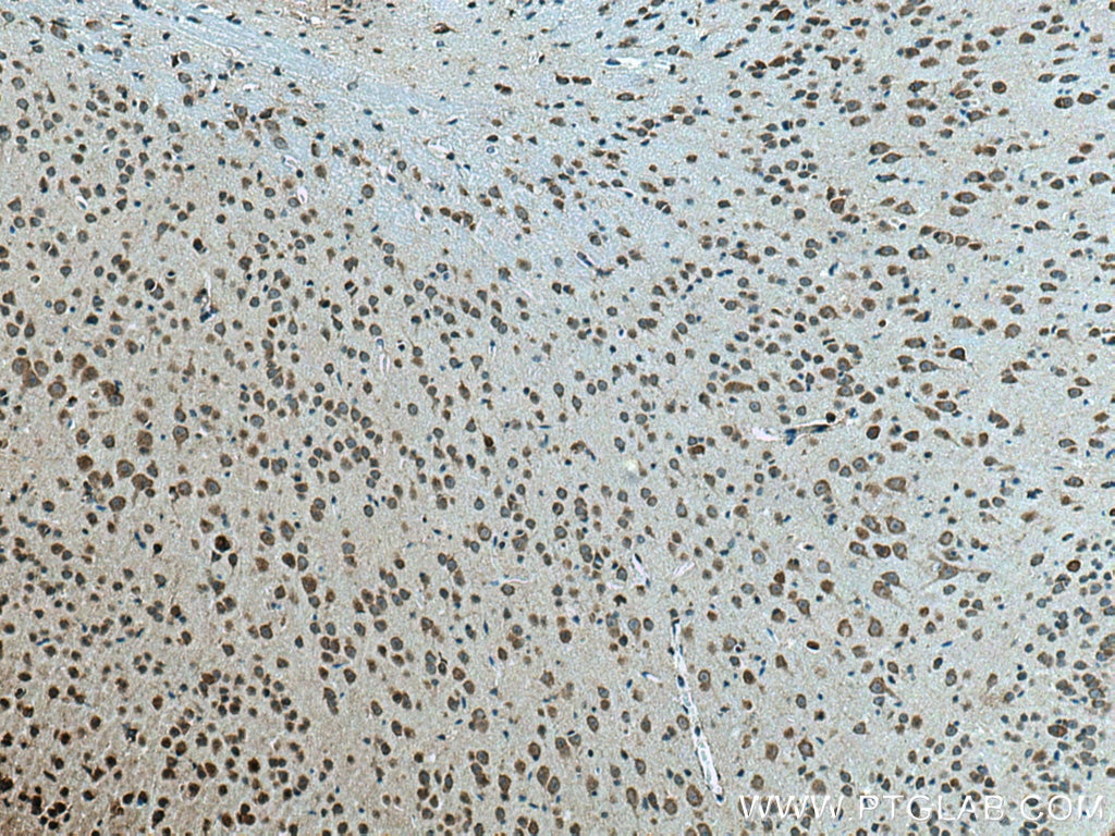 Immunohistochemistry (IHC) staining of mouse brain tissue using SLC24A4 Polyclonal antibody (18992-1-AP)