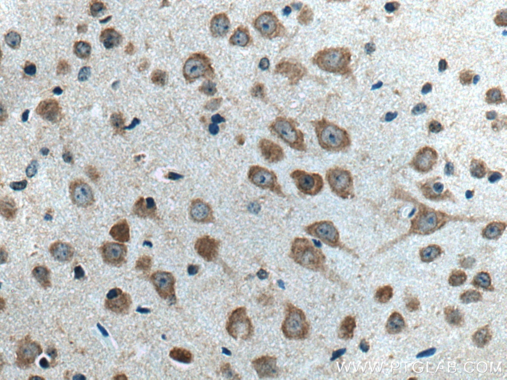 Immunohistochemistry (IHC) staining of mouse brain tissue using SLC24A4 Polyclonal antibody (18992-1-AP)