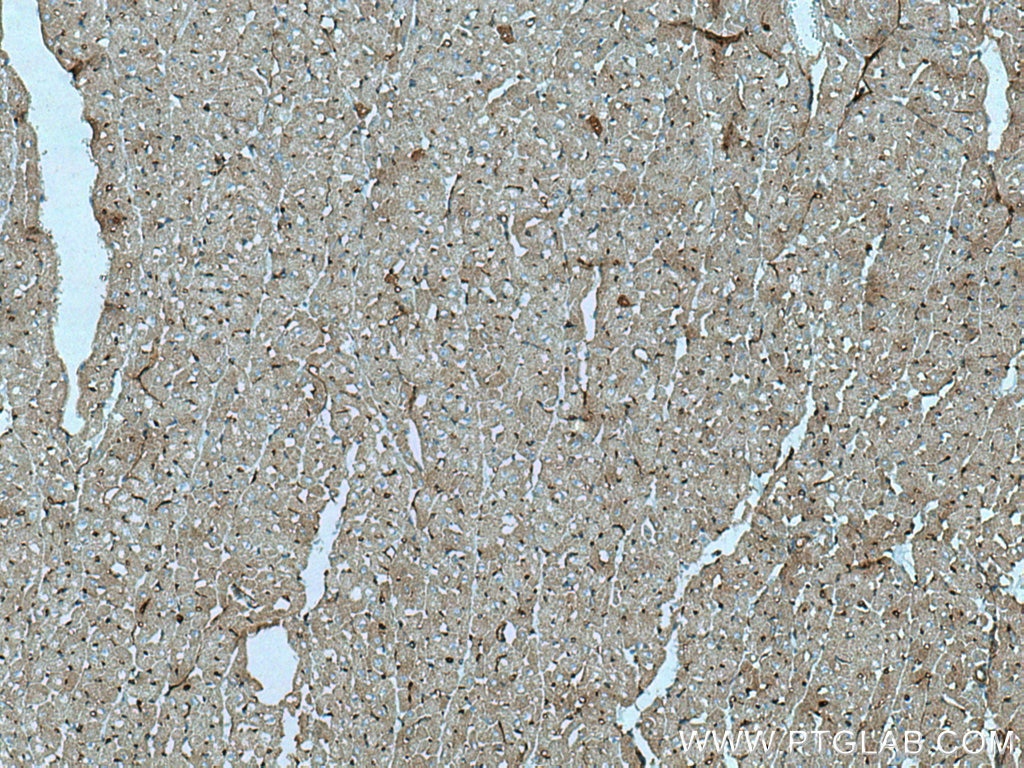 Immunohistochemistry (IHC) staining of human heart tissue using SLC24A4 Polyclonal antibody (18992-1-AP)