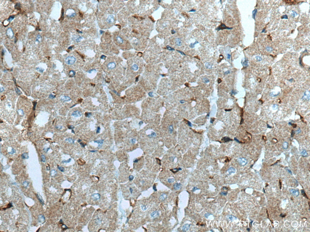 Immunohistochemistry (IHC) staining of human heart tissue using SLC24A4 Polyclonal antibody (18992-1-AP)