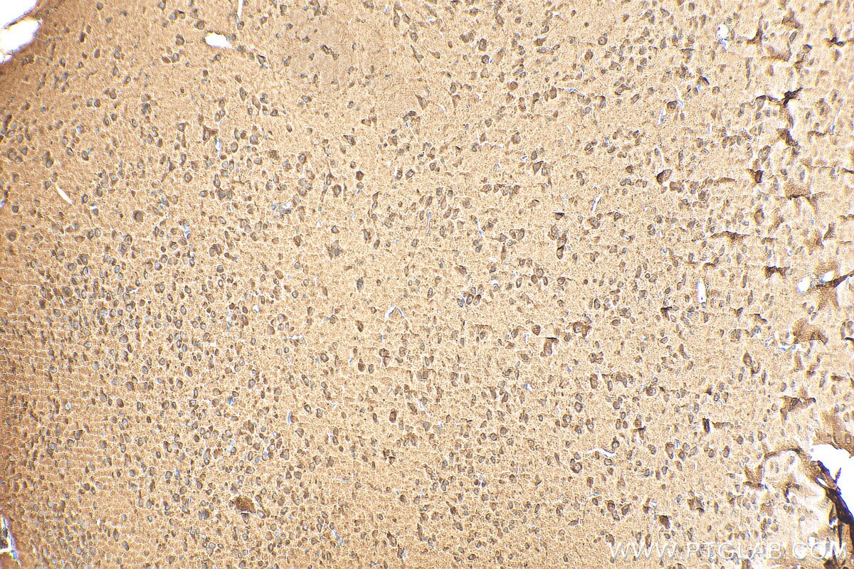 Immunohistochemistry (IHC) staining of mouse brain tissue using SLC24A4 Polyclonal antibody (18992-1-AP)