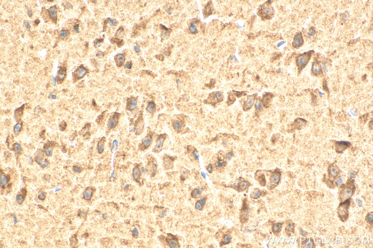 Immunohistochemistry (IHC) staining of mouse brain tissue using SLC24A4 Polyclonal antibody (18992-1-AP)