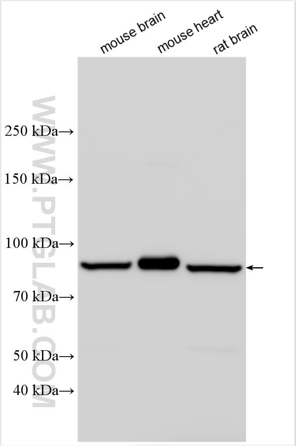 Western Blot (WB) analysis of various lysates using SLC24A4 Polyclonal antibody (18992-1-AP)