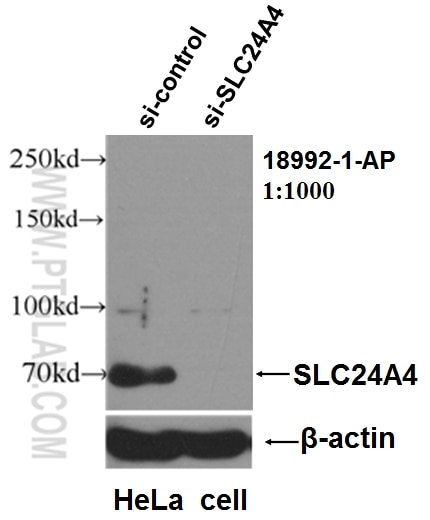 Western Blot (WB) analysis of HeLa cells using SLC24A4 Polyclonal antibody (18992-1-AP)