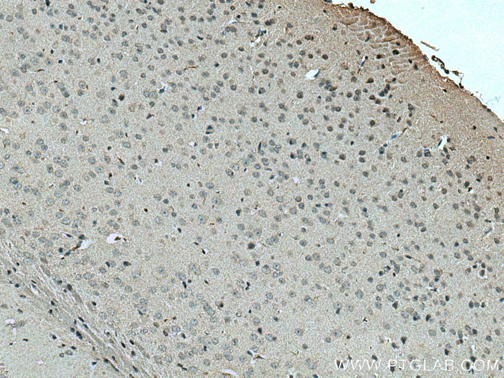 Immunohistochemistry (IHC) staining of mouse brain tissue using SLC24A6 Polyclonal antibody (21430-1-AP)