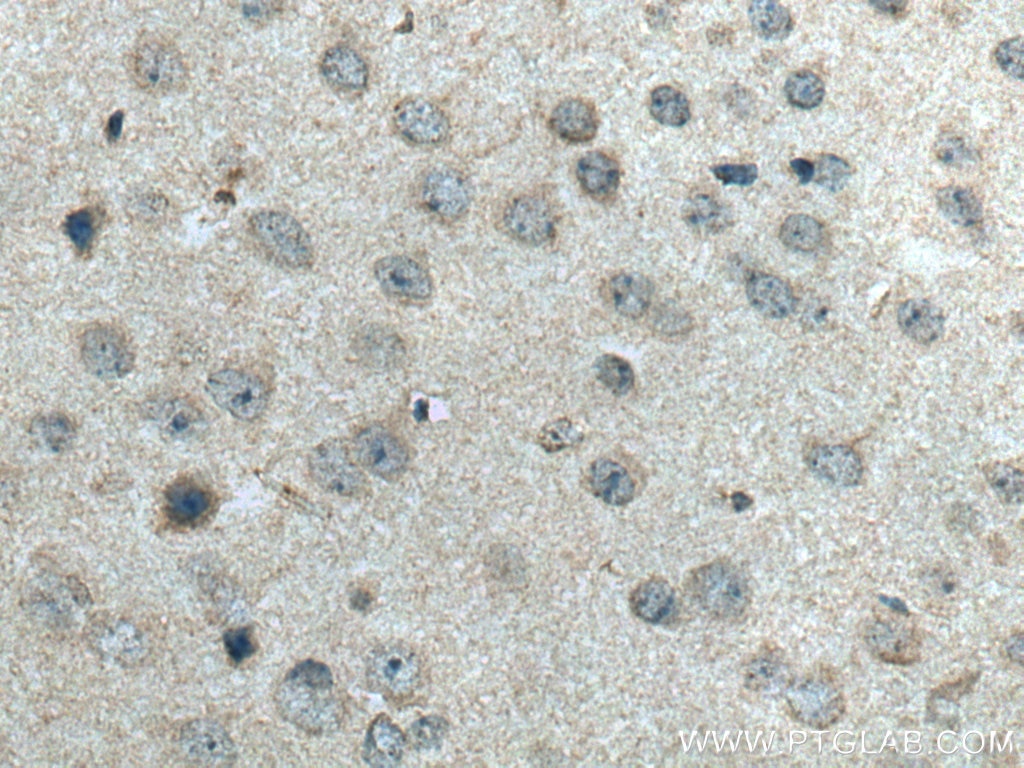 Immunohistochemistry (IHC) staining of mouse brain tissue using SLC24A6 Polyclonal antibody (21430-1-AP)