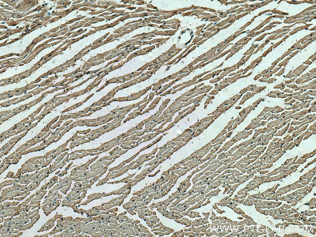 Immunohistochemistry (IHC) staining of mouse heart tissue using SLC24A6 Polyclonal antibody (21430-1-AP)