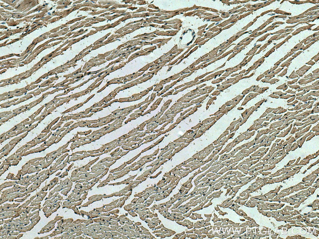 IHC staining of mouse heart using 21430-1-AP