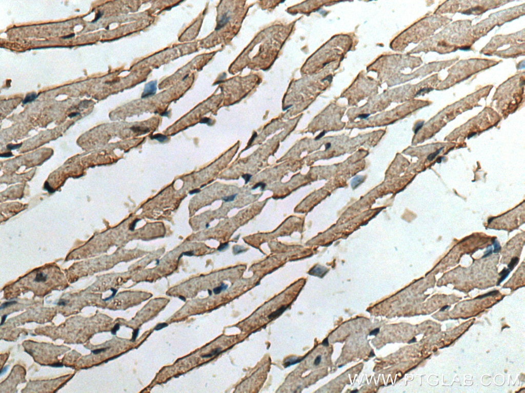 Immunohistochemistry (IHC) staining of mouse heart tissue using SLC24A6 Polyclonal antibody (21430-1-AP)