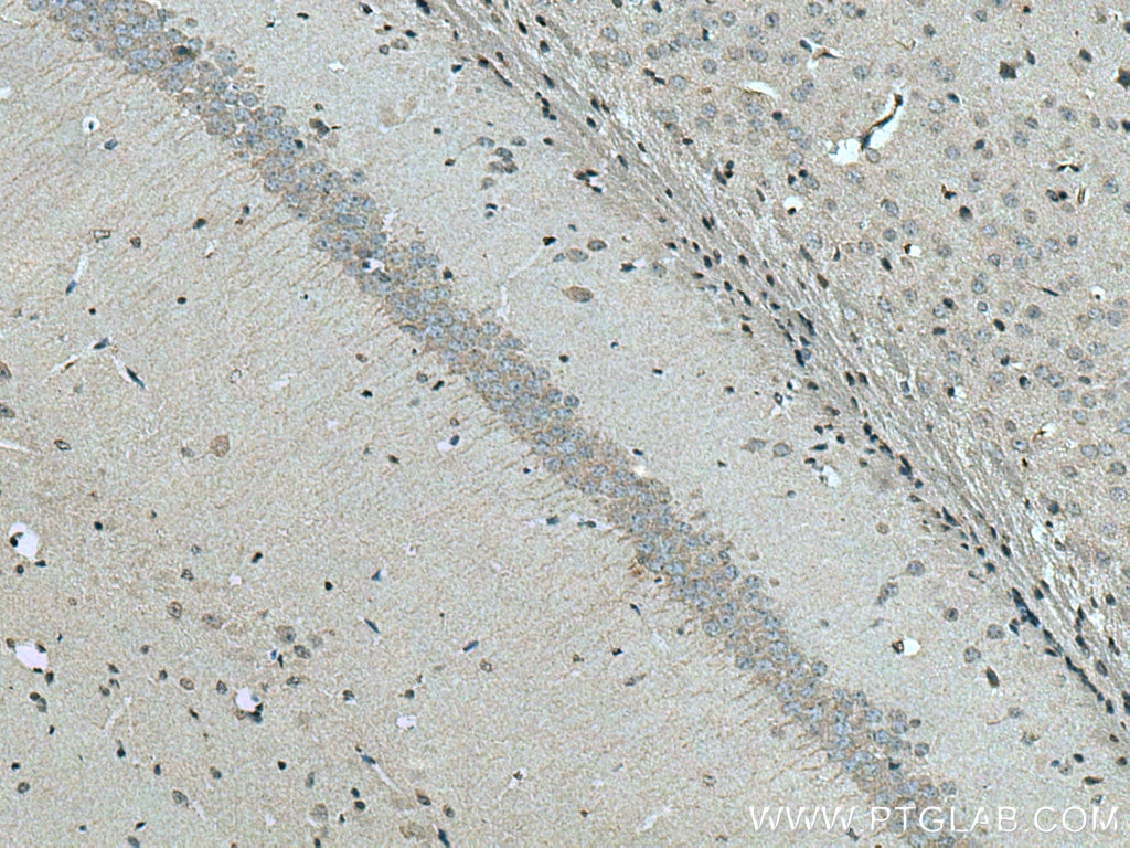 Immunohistochemistry (IHC) staining of mouse brain tissue using SLC24A6 Polyclonal antibody (21430-1-AP)