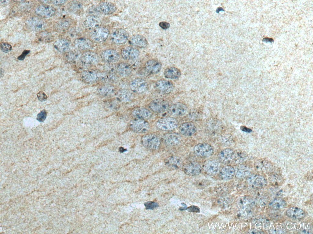 Immunohistochemistry (IHC) staining of mouse brain tissue using SLC24A6 Polyclonal antibody (21430-1-AP)