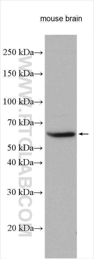 Western Blot (WB) analysis of various lysates using SLC24A6 Polyclonal antibody (21430-1-AP)