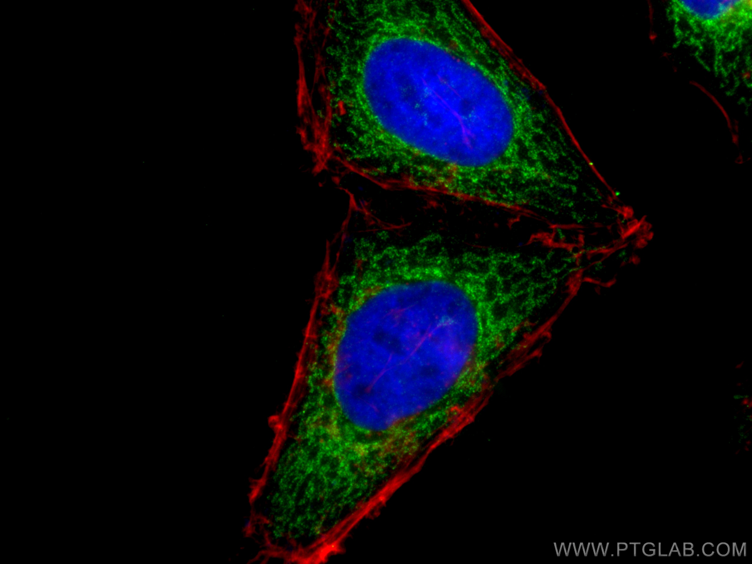 Immunofluorescence (IF) / fluorescent staining of HeLa cells using SLC25A1 Polyclonal antibody (15235-1-AP)