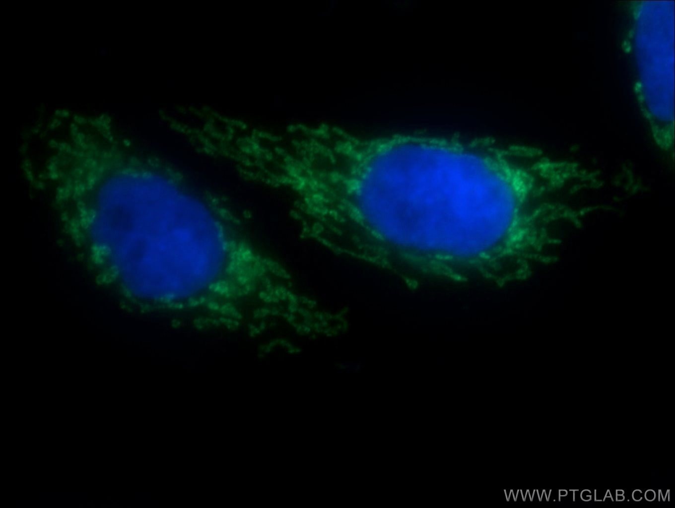 Immunofluorescence (IF) / fluorescent staining of HepG2 cells using SLC25A1 Polyclonal antibody (15235-1-AP)