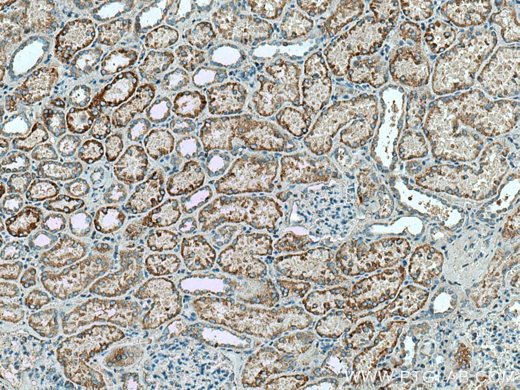 IHC staining of human kidney using 15235-1-AP