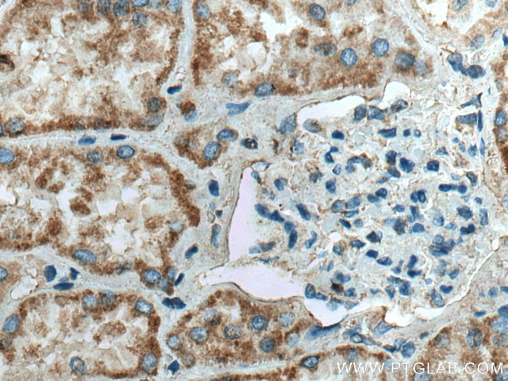 Immunohistochemistry (IHC) staining of human kidney tissue using SLC25A1 Polyclonal antibody (15235-1-AP)