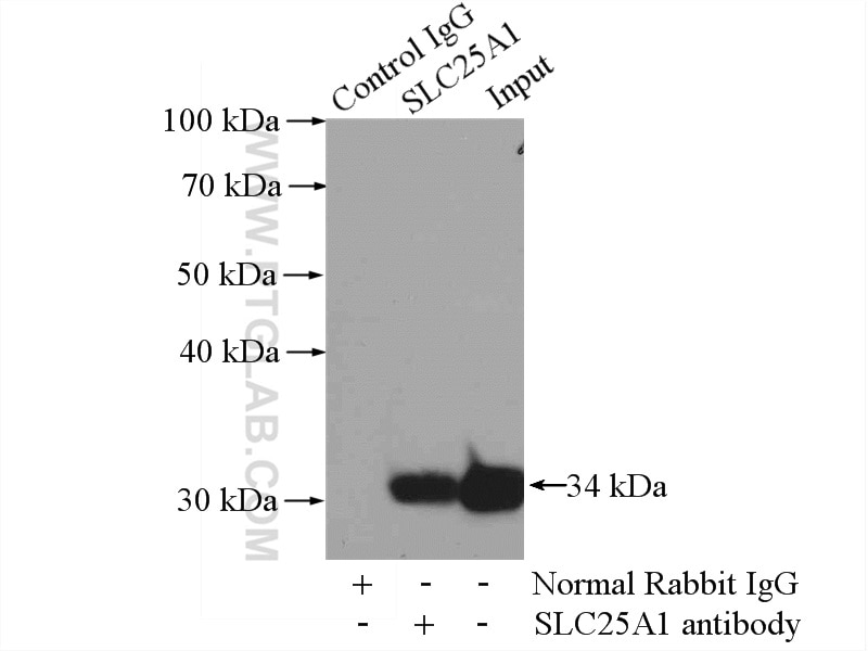 Immunoprecipitation (IP) experiment of HeLa cells using SLC25A1 Polyclonal antibody (15235-1-AP)