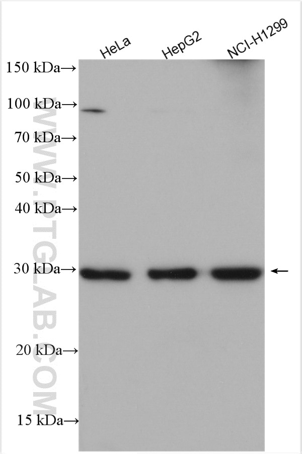 Western Blot (WB) analysis of various lysates using SLC25A1 Polyclonal antibody (15235-1-AP)