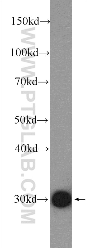 Western Blot (WB) analysis of rat liver tissue using SLC25A1 Polyclonal antibody (15235-1-AP)