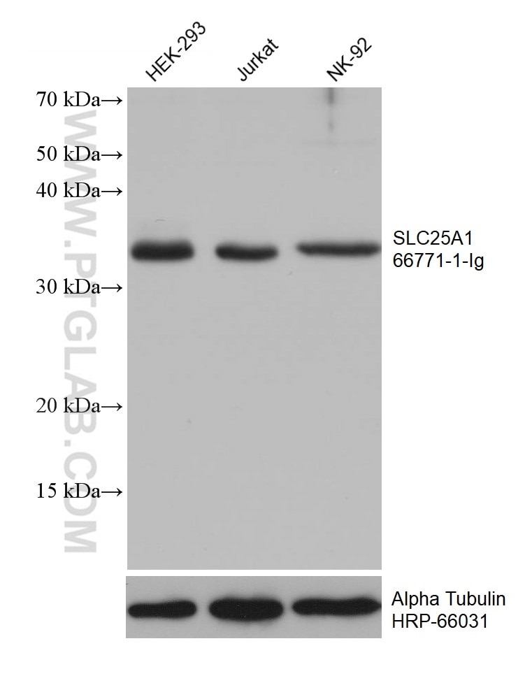 Western Blot (WB) analysis of various lysates using SLC25A1 Monoclonal antibody (66771-1-Ig)