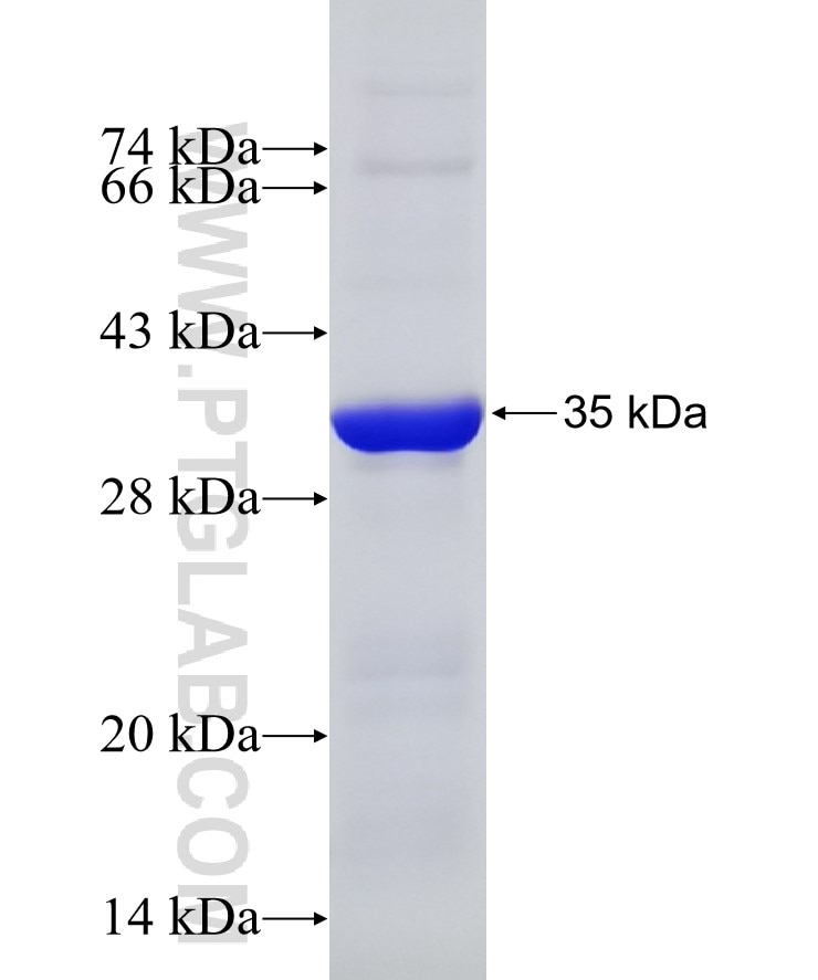 SLC25A1 fusion protein Ag7520 SDS-PAGE