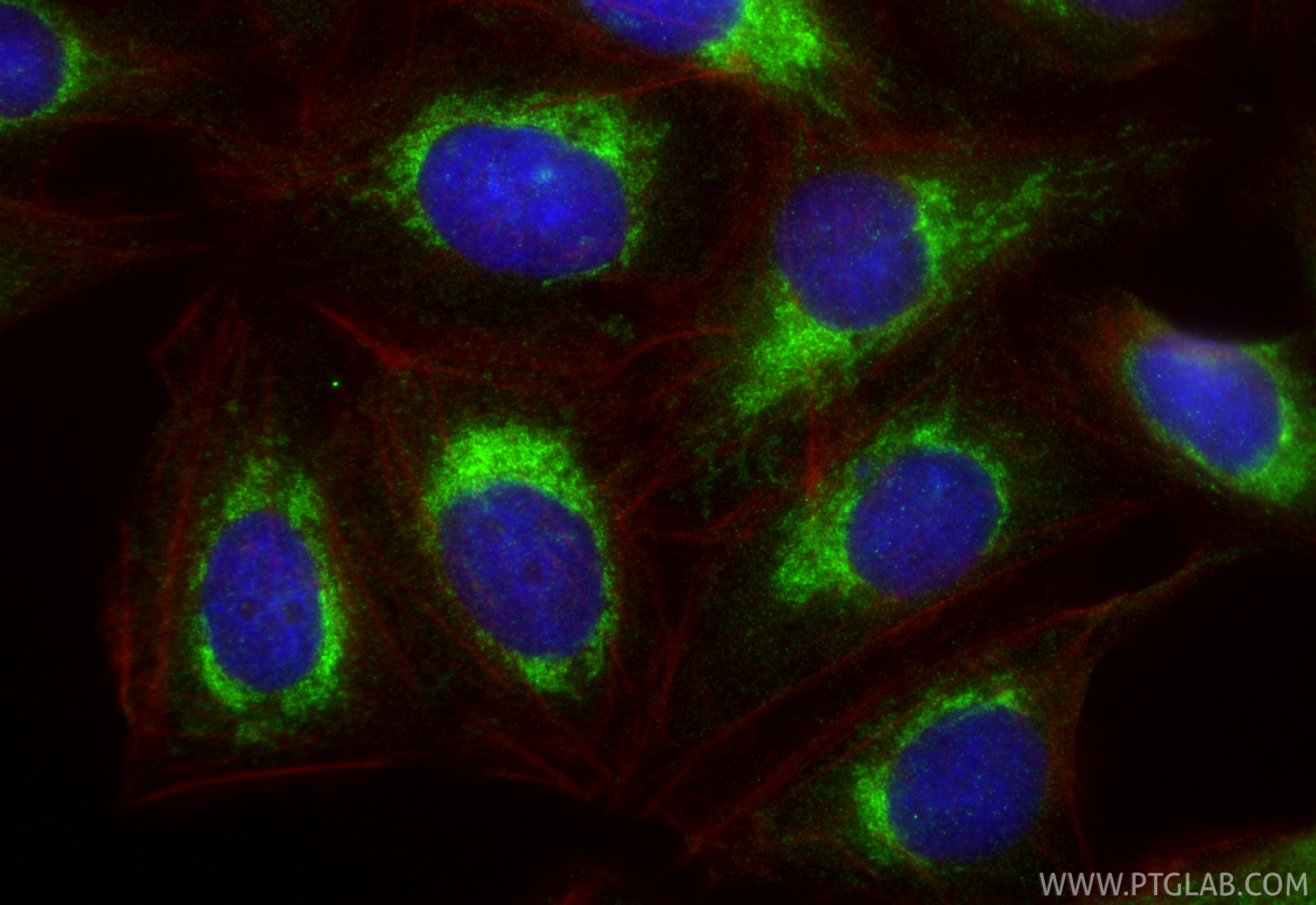 Immunofluorescence (IF) / fluorescent staining of U2OS cells using SLC25A10 Polyclonal antibody (12086-1-AP)