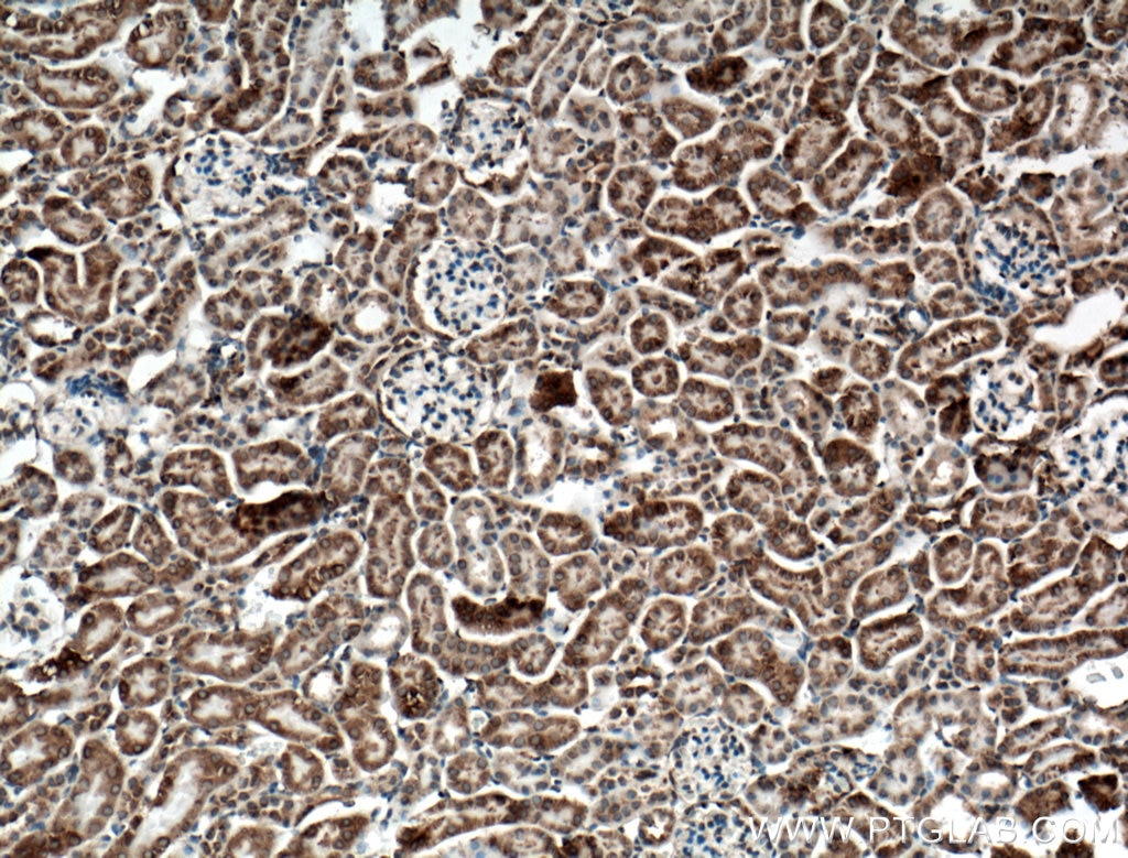 Immunohistochemistry (IHC) staining of mouse kidney tissue using SLC25A10 Polyclonal antibody (12086-1-AP)