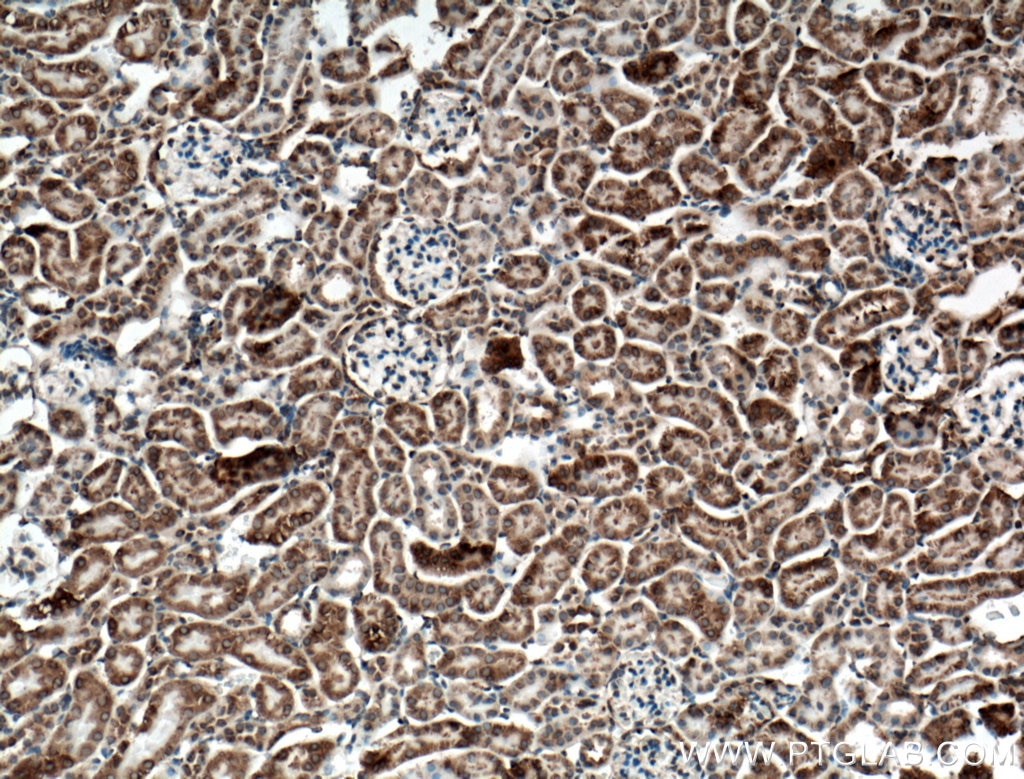 IHC staining of mouse kidney using 12086-1-AP