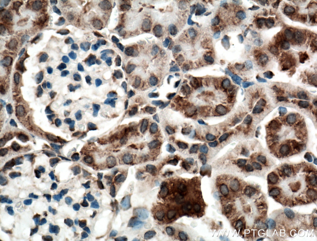 Immunohistochemistry (IHC) staining of mouse kidney tissue using SLC25A10 Polyclonal antibody (12086-1-AP)