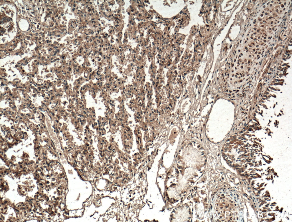 Immunohistochemistry (IHC) staining of human lung tissue using SLC25A10 Polyclonal antibody (12086-1-AP)