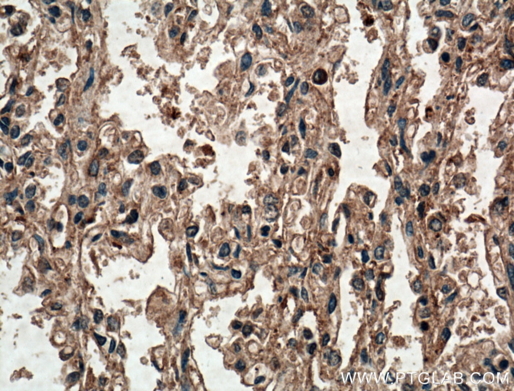 Immunohistochemistry (IHC) staining of human lung tissue using SLC25A10 Polyclonal antibody (12086-1-AP)