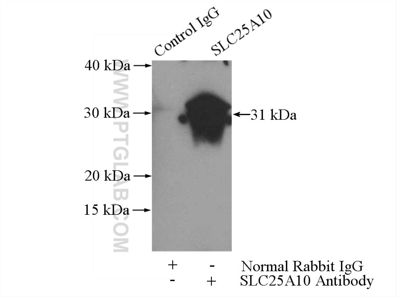 Immunoprecipitation (IP) experiment of mouse liver tissue using SLC25A10 Polyclonal antibody (12086-1-AP)