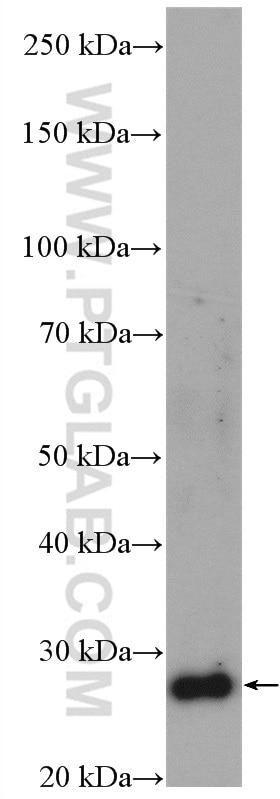 Western Blot (WB) analysis of A549 cells using SLC25A10 Polyclonal antibody (12086-1-AP)